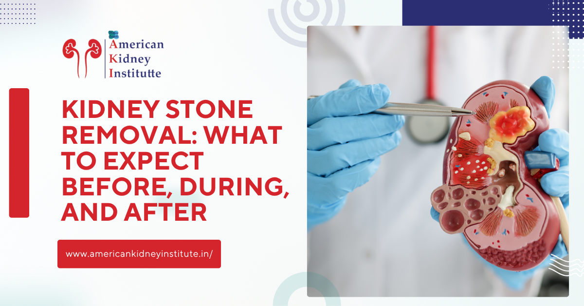 Banners in american kidney institute